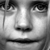 Black-and-white close-up of a human face showing eyes, nose, mouth, and partial hair strands, cropped tightly around facial features.