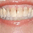 A split image shows a close-up of teeth and lips on the left, with green pixelated text reading "I LOVE CONSUMER SERVICES" on a yellow background to the right.