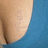 A static pixelated image showing a partial view of a light-skinned figure's shoulder and upper arm against a solid blue background.