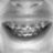A grayscale animated sequence showing a mouth with braces in three distinct states: closed, open, and smiling. The animation cycles through these expressions.