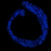 Two blue circular shapes and one orange X-shaped symbol on a black background with a white rectangle in the bottom right corner.