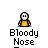 badassbuddy_com-bloodynose