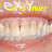 Pixelated close-up of a mouth with teeth, displaying yellow text reading 'Consumer Services' above the lips.