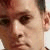 Pixelated close-up of a person's face showing eyes, nose, and mouth with brown hair visible on the right side.