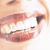 A contact sheet of two animated frames showing a person's mouth with braces, alongside a