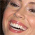 A close-up of a person's face showing lips parted to reveal teeth, with visible skin texture and partial eye and nose details.