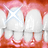 Static 48x48 pixel icon depicting a stylized dental examination scene with two large white teeth, pink gums, and blue X-ray lines on a gray background.