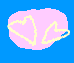 Two pink heart-shaped icons with yellow outlines on a blue background, showing animation changes between frames.