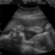 Grayscale ultrasound image of a fetus in a cone-shaped field with visible limbs and head, displayed in a with four