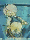 Animated sequence of a cartoon baby in a blue outfit against a teal background, showing sequential movement from standing to bending over.
