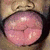 A close-up of a person's mouth with lips parted, next to pixelated text on a black background.