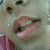 A close-up of a person's mouth and nose with lips parted, showing teeth in three