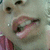 A close-up of a person's mouth and nose with lips parted showing teeth, displayed in a four