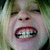 A pixelated close-up of a person with light hair and braces, next to bold text reading "You wanna piece of me?" on a white background.