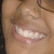 A person's mouth and nose in a close-up, showing teeth with varying visibility across frames.