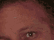 Two side-by-side close-up views of a person's face with reddish-brown skin tone, showing different angles of the eyes and nose against a dark background.
