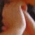 A pixelated close-up of a light-skinned figure's shoulder and arm with visible red marks on the skin, set against a blurred brown background.