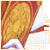 Animated icon shows a golden, textured object with red and orange accents against white background; two versions differ in border color.