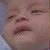 A baby's face with a bandage on the cheek, showing slight variations in expression and background across four