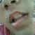 A close-up of a person's mouth and nose with lips parted, showing teeth in three