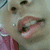 A close-up of a person's face showing mouth and nose with lips parted, teeth visible, wearing glasses and pink clothing.