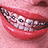 A contact sheet of six animated frames showing a person's mouth with braces, red lips, and visible teeth in various smiling expressions.