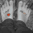 Animated sequence showing a red heart appearing on a black-and-white image of two hands holding a small object, followed by a heart-shaped lipstick mark on a light background.
