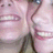 Pixelated close-up of a character's face with pinkish skin tone, visible teeth, and dark hair strands against a light background.