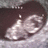 Two side-by-side ultrasound images of a fetus in the womb with blue text reading 'baby inside' at bottom right.